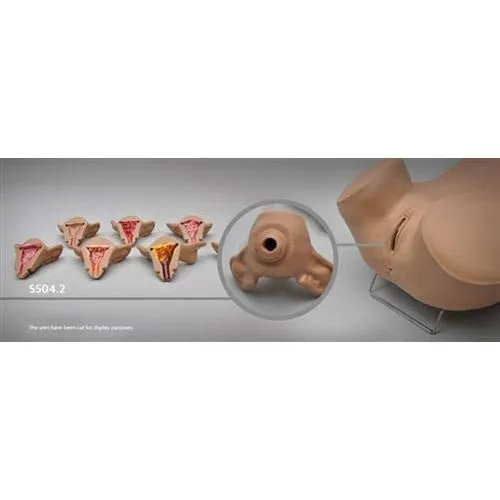 Normal and Abnormal Uteri Set for ZOE S504.100